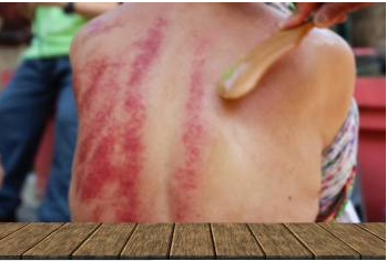 Je väčší tlak lepší v Gua Sha?